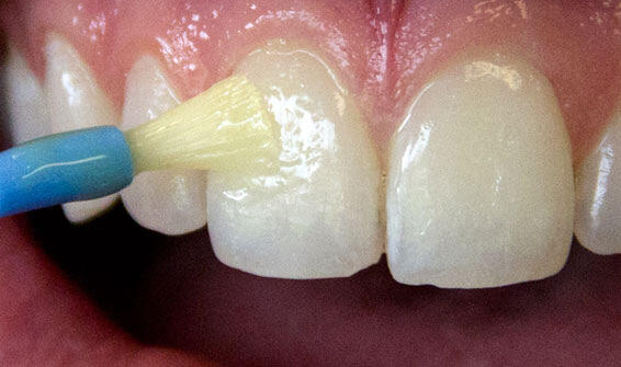 downloaded from www.srivinayagadental.com