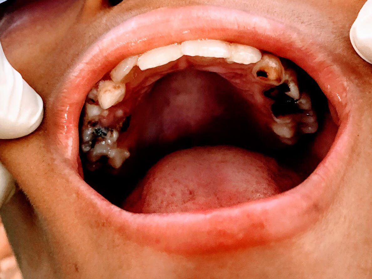 downloaded from www.srivinayagadental.com