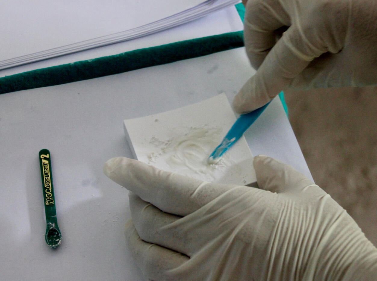 Hand-mix Glass Ionomer Cement