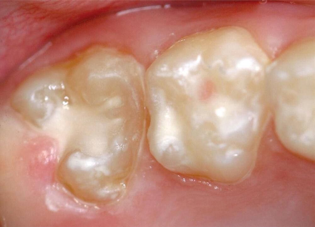 downloaded from www.srivinayagadental.com